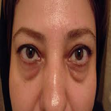 ir.darmane.sare.pof.cheshm.d