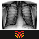 com.hkbu.ulip.chestxray