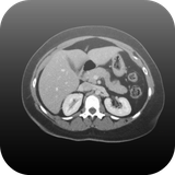 mdtoolkit.ctviewer