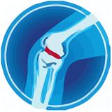 com.eurowall.kneepain_physicaltherapyexercises