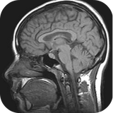 mdtoolkit.mriviewer