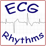 com.XeloMed.ECGRhythm