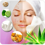 com.brooztarin.acne