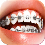 com.braces.selfie.camera.photo.editor_sticker